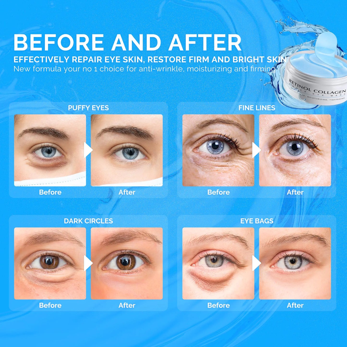 Enaskin Naturals Under Eye Patches for Dark Circles: 30 Pairs Retinol Collagen Eye Gels Mask - Reduce Wrinkles Puffy & Bags - Skin Treatment Pads - Anti Aging Moisturizer For Women (Blue) Blue